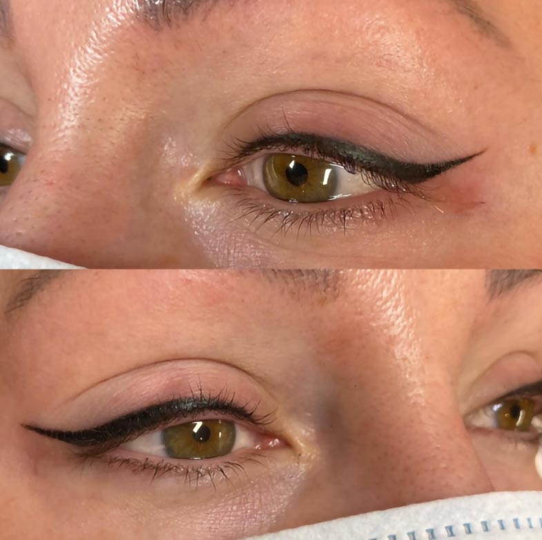 Microblading dangers: Public health officials raise alarm about unlicensed  practitioners | CTV News