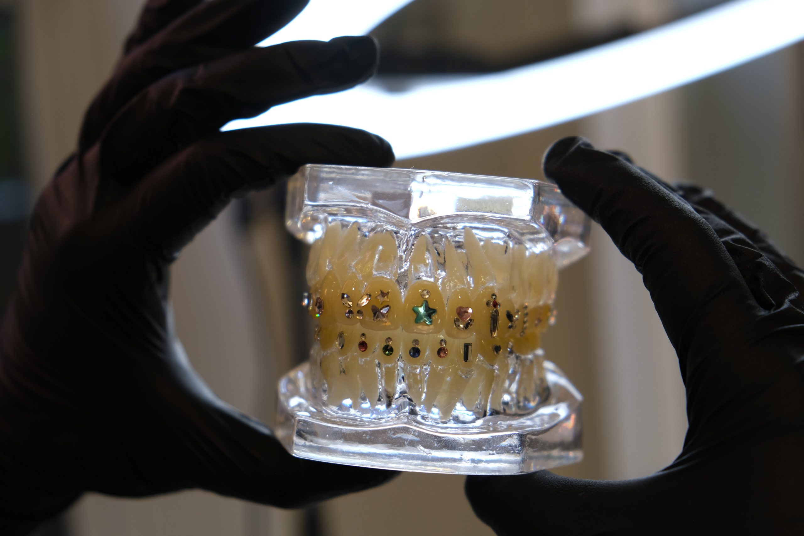 Tooth gem selection on display